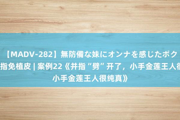 【MADV-282】無防備な妹にオンナを感じたボク。 3 并指免植皮 | 案例22《并指“劈”开了，小手金莲王人很纯真》